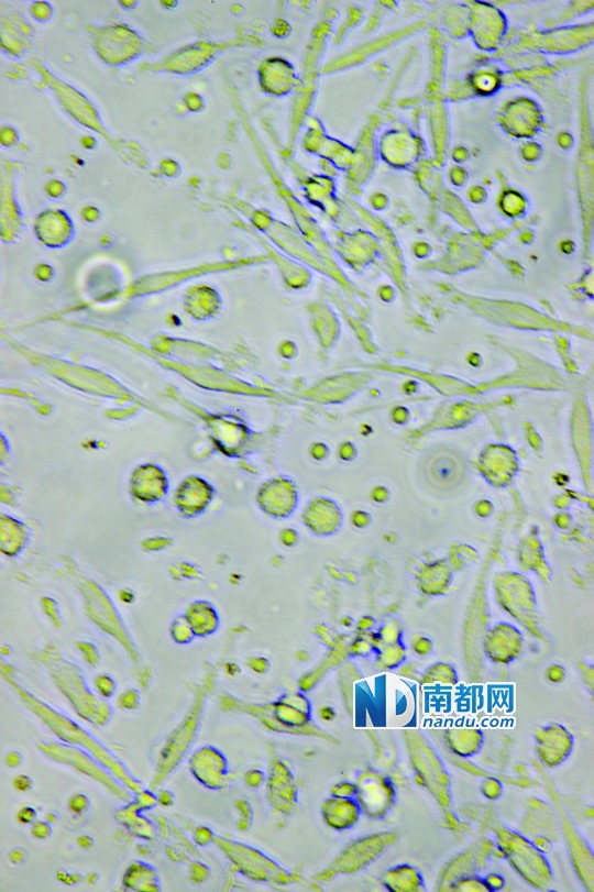 <p>&nbsp;&nbsp;&nbsp;&nbsp;&uarr;目前臨床應用最廣泛的細胞生物治療是C&nbsp;IK細胞治療，在顯微鏡下可清晰看到D&nbsp;C細胞(葉片形狀)和C&nbsp;IK細胞(圓點形狀)。</p>
